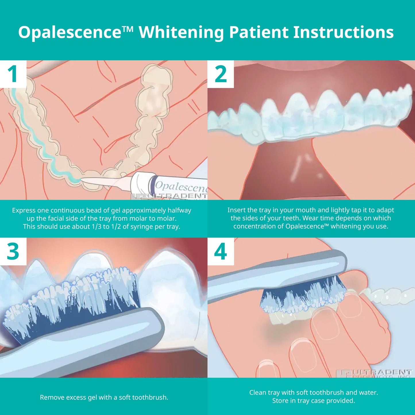 Opalescence at Home Teeth Whitening - Teeth Whitening Gel Syringes - 4 Pack of 20% Syringes - Mint