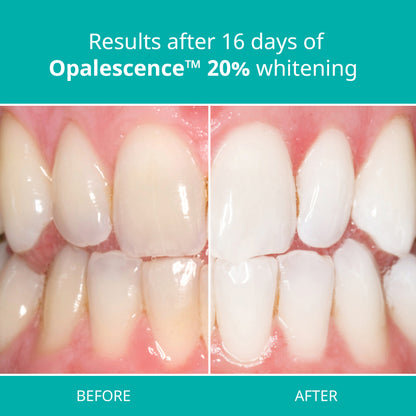 Opalescence at Home Teeth Whitening - Teeth Whitening Gel Syringes - 4 Pack of 20% Syringes - Mint